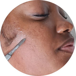 Dermaplaning : 1H00