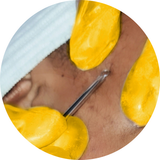 Dermaplaning + extraction : 1H00